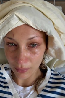 Bella Hadid shares photos of her during undisclosed medical treatment