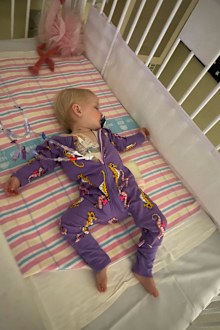Sophia had to have most procedures done under a general anesthetic because of her age.