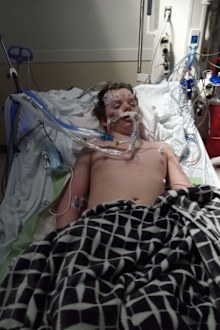 Jacob Stevens, 13, died after attempting the Benadryl Challenge.