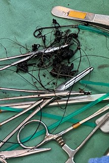 Seven hooks were removed from the animal along with line.