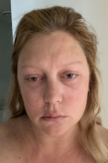 Mel Greig took this photo just before being admitted to a mental health recovery facility.