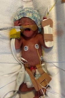 Scarlett premature birth