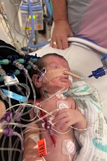 Miracle twins Lucas and Bailey