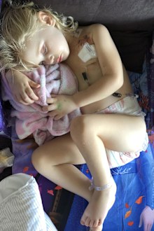 Cancer treatment took a toll on Sophie's tiny body.