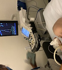 Cancer treatment took a huge physical and emotional toll on Isla.