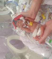 premature birth miracle baby Mater Mothers' Hospital in South Brisbane