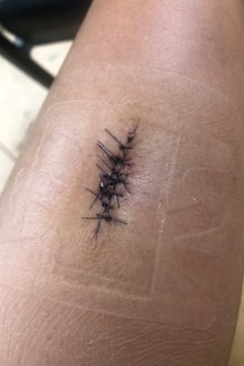 Skin cancer checks