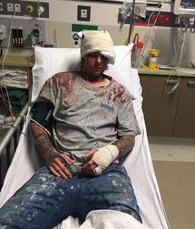 Lee Walker in hospital on Monday after being attacked with a shovel. 