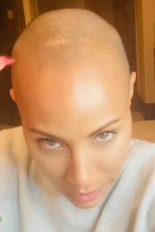 Jada Pinkett Smith hair loss