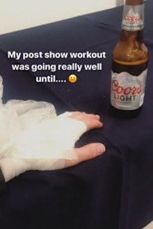 Nick Jonas shares photo of injured hand in 2018.