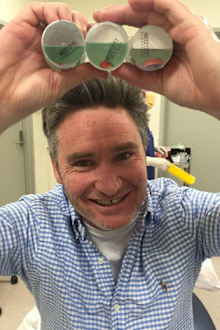 Dave Hughes after a skin cancer removal procedure in 2016.