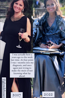 Deborah James image comparison