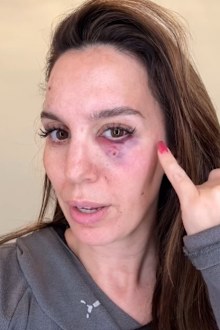 Christy Carlson Romano reveals she was shot in the face