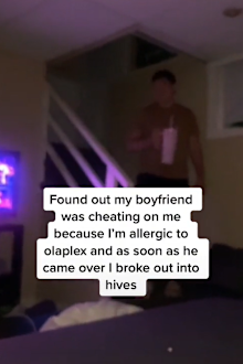 Boyfriend cheating sign rash hives