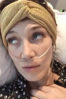 Delta Goodrem had surgery in October 2018 to remove the salivary gland