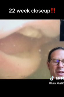 Dr Narvey has over 660,000 followers. 