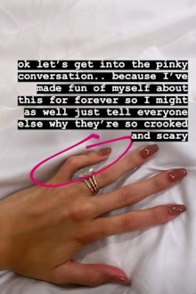 Hailey Baldwin, pinky, health condition, Instagram