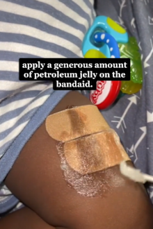 Mum reveals 'amazing' hack for removing bandaids painlessly.