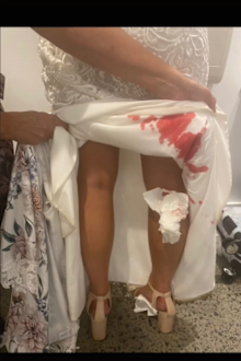 Bride's horrific discovery after first dance with new husband.