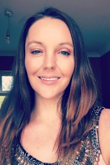 Woman who lost forehead in car crash shares warning