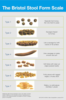 Bristol stool chart