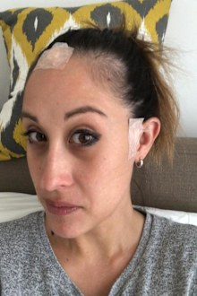 Frances van der Velden had the lump biopsied to figure out what it was.