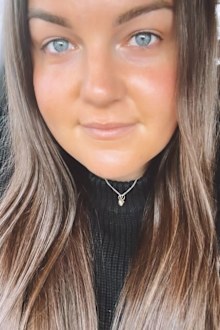 Kasey has no eyelashes left after the drastic move.