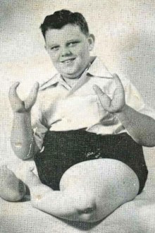 Grady Stiles appeared in circus 'freak shows' because of his abnormality.