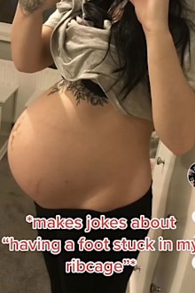 Bethany Love shares photo of baby's misshapen feet that were stuck under her rib cage