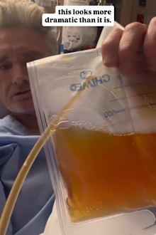 Dave Hughs lung fluid