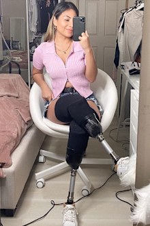 Juttima Chinnasri now embraces her disability and has regained her confidence.
