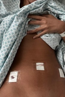 Emily Miller reveals she was hospitalised for an ectopic pregnancy just weeks after discovering she was pregnant.