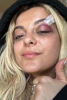 Bebe Rexha shares update for fans following assault on stage at concert.