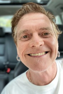 Def Leppard drummer Rick Allen. Fans have nicknamed the drummer 'The Thunder God'.