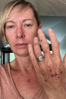 skin check deborah knight 