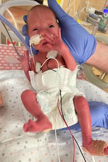 Megan Schutt's daughter Rylee in hospital shortly after her birth.