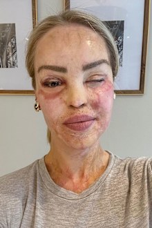 Katie Piper