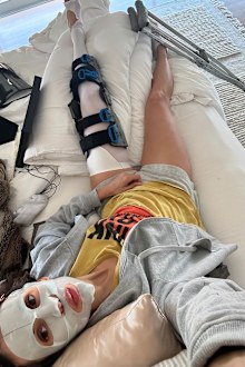 Nina Dobrev shares update after bike injury