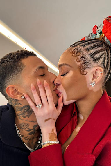 Winnie Harlow and Kyle Kuzma