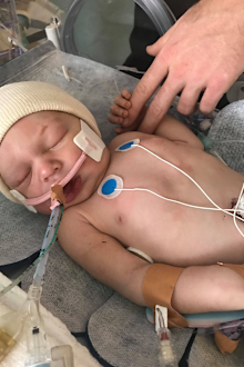 He suffered a brain injury at birth due to oxygen deprivation.