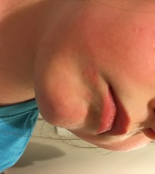 Since switching products the rash has cleared up.