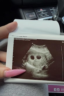 Veruca Salt pregnant with twins 
