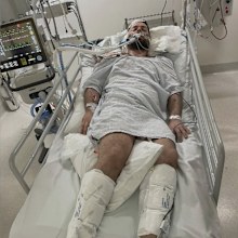 Twenty-five-year-old Kevin Vidovic remains in hospital with critical injuries nearly two months after he was set upon.