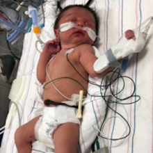 The baby was found after a man heard her crying in the woods.