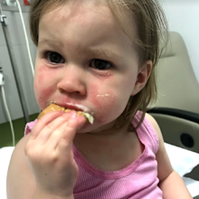 Poppy eczema eating a sandwich in hospital