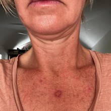 skin check deborah knight 
