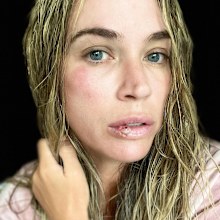Former Real Housewives of Beverly Hills star Teddi Mellencamp shares photo of 'busted' face.