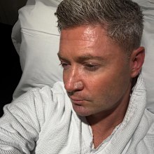 Clarke also took to Instagram to share that he had a melanoma cut out of his nose, warning others to stay vigilant. 