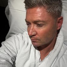 Clarke also took to Instagram to share that he had a melanoma cut out of his nose, warning others to stay vigilant. 