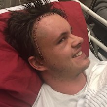 Johnny Ruffo gives update on cancer battle. 'Still fighting' five years on.